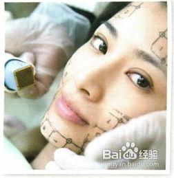 电波拉皮视频,揭秘无创抗衰老的神奇之旅
